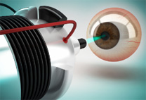 PRK/Phototherapeutic Keratectomy