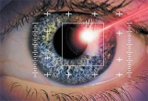 Femtosecond Lasik