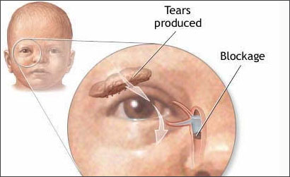 Other Treatments